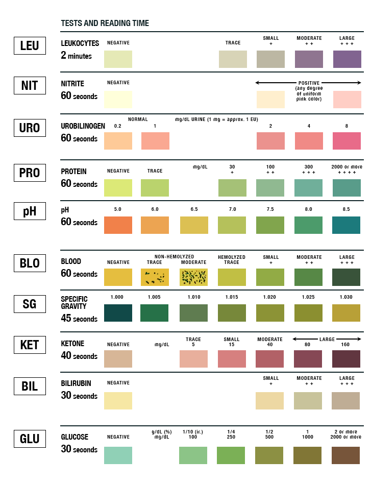 Urinalysis Test Strip Color Chart | LEARN.PARALLAX.COM
