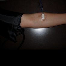 Blood pressure is measured by two sensors: the MEAS vibra sensor and the pressure sensor as shown.